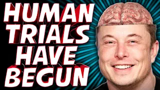 Someone Let Elon Put A Computer In Their Brain - TechNewsDay