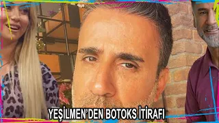 🌏Yeliz Yeşilmen: Erkekler botoks yaptırmasın!