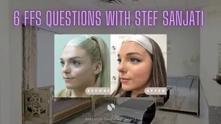 6 Facial Feminization Surgery Questions at The Spiegel Center with Stef Sanjati