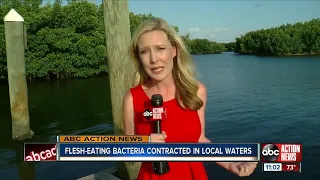 Flesh-eating bacteria contracted in Tampa Bay area waters