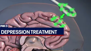 Depression treatment using magnetic stimulation