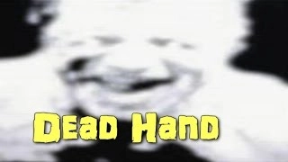 SCP-1984 Dead Hand | Object Class: Keter