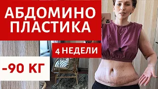 ТАКОГО Я НЕ ОЖИДАЛА! |  4 НЕДЕЛИ | ДО И ПОСЛЕ | АБДОМИНОПЛАСТИКА |  ПОДТЯЖКА ЖИВОТА И РУК