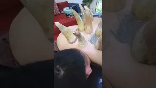 Horn cupping