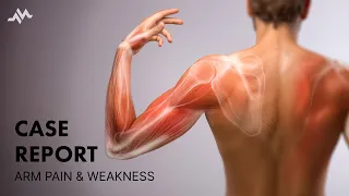 Arm Pain and Weakness - Case Report