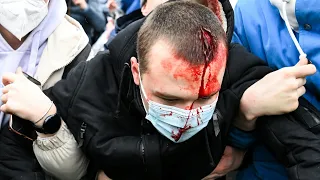 Scharfe Kritik an Polizeigewalt bei Protesten in Russland | AFP