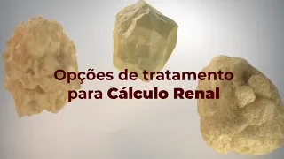 Opções e tratamento para CÁLCULO RENAL
