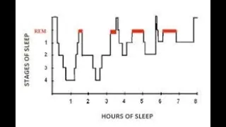 Sleep Doctor Answers the question, "Is Sleep Before Midnight Better for Health"?