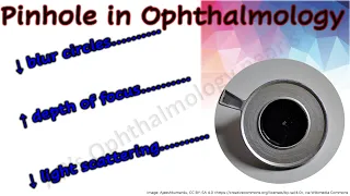 Pinhole in Ophthalmology