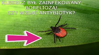 💀Ugryzł mnie kleszcz. W laboratorium go zbadano i potwierdzono boreliozę. Czy wziąć antybiotyk?