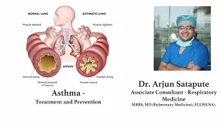 Treatment & Prevention of Asthma | Sakra World Hospital