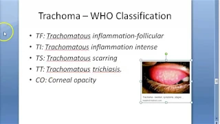 Ophthalmology 076 d Trachoma WHO Classification FISTO
