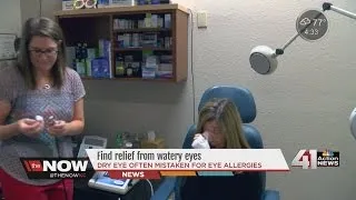 VIDEO: Difference between red eye and allergies