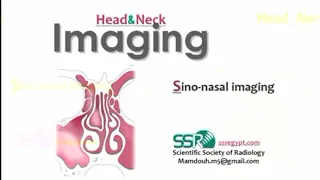 Imaging of Paranasal sinuses (DRE) Prof. Mamdouh Mahfouz