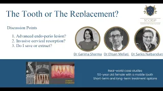 Webinar 8 - The Tooth or The Replacement?