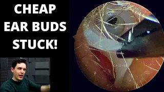 Ear Buds Welded To Ear Canals!