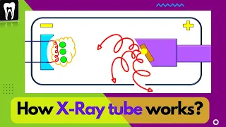X-Ray Tube & Components| Dental X Ray tube | How does X Ray Work