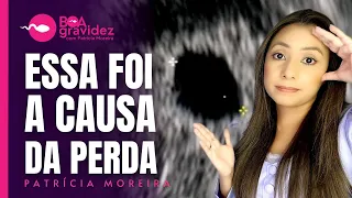 🚨SAIU O LAUDO DA PERDA! Gravidez Anembrionária | Causas, sintomas e como estou após a perda ❤️‍🩹