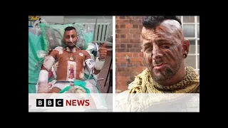 British soldier returns to Ukraine after life-changing injury - Britain Today