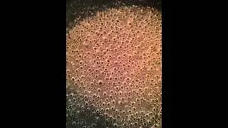 trypophobia & asmr