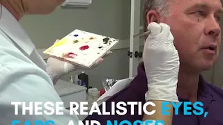 Realistic facial prosthetics change lives