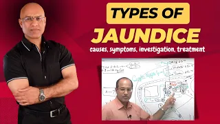 Types Of Jaundice | Causes Symptoms & Treatment | Dr Najeeb