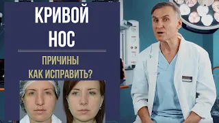 КРИВОЙ НОС 🤥 КРИВАЯ ПЕРЕГОРОДКА НОСА: КАК ВЫРОВНЯТЬ?