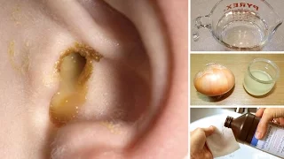 6 Best Home Remedies for Getting Rid of Swimmer's Ear