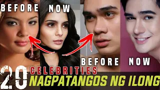 Di mo aakalaing mga PANGO pala sila noon. | FILIPINO CELEBRITIES NA NAGPATANGOS NG ILONG.