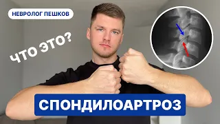 СПОНДИЛОАРТРОЗ что это ? Невролог Пешков