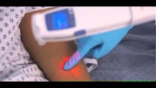 AccuVein AV400 vein illumination system - MDEA 2013 Gold Winner