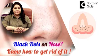 Black Dots on the Nose? Know how to treat them ! #blackhead  - Dr.Tina Ramachander | Doctors' Circle