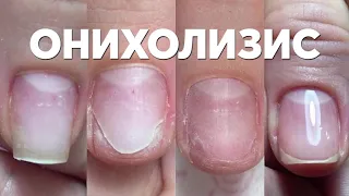 «Заболевания ногтевой пластины» онлайн курс | Ксения Чумак