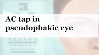 Anterior Chamber tap in pseudophakic eye