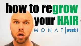 How To Regrow Hair | Week 1 RESULTS | My Journey | MONAT