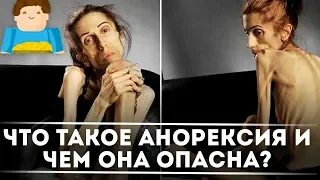 Что такое анорексия и чем она так опасна? [Plushkin]