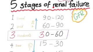 Mnemonic: the 5 Stages of chronic kidney disease, based on GFR