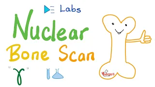 Nuclear Bone Scans | Radiology