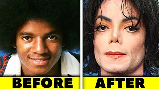 Michael Jackson Plastic Surgeries & Mental Health