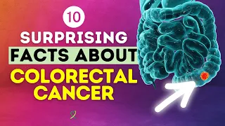 10 Surprising Facts About Colorectal Cancer