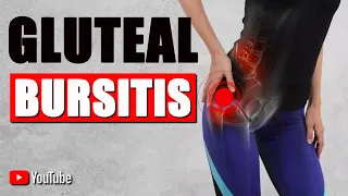 GLUTEAL BURSITIS. BEST STRETCHES, EXERCISES & ADVICE for Hip Pain Relief..!!