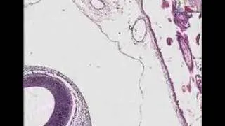 Histopathology Fallopian tube--Ectopic pregnancy with embryo