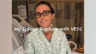 My Spleen Rupture with VEDS (Vascular Ehlers-Danlos syndrome)