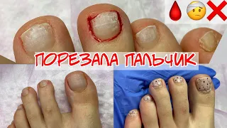 Cut a finger 🩸 Pedicure to myself 🤕 Pedicure errors