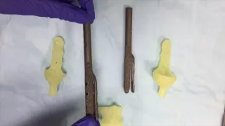 Остеоинтегрируемое протезирование двух тазовых конечностей у собаки