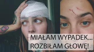 Miałam WYPADEK *trzeba było szyć twarz?!* ~ daily vlog