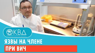 Язвы на члене при ВИЧ. Клинический случай №102