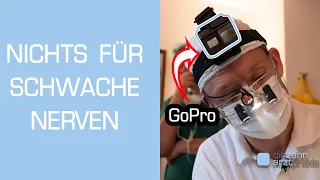 Zahnarzt filmt Weisheitszahn OP mit GoPro (Vollnarkose)