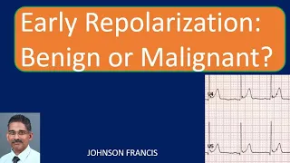 Early Repolarization: Benign or Malignant?