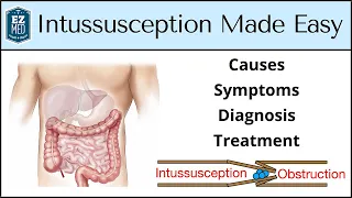 Intussusception: Causes, Symptoms, Diagnosis, Treatment [Nursing, USMLE]